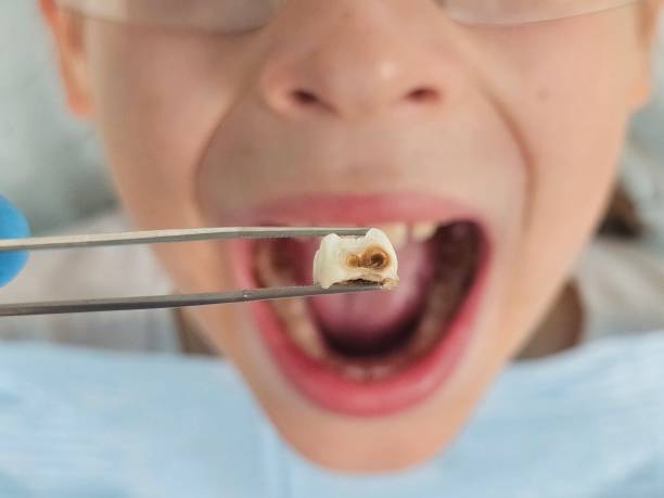 Best Broken Tooth Emergency  in Belpre, OH