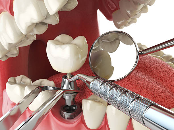 Best Dentist for Tooth Abscess  in Belpre, OH